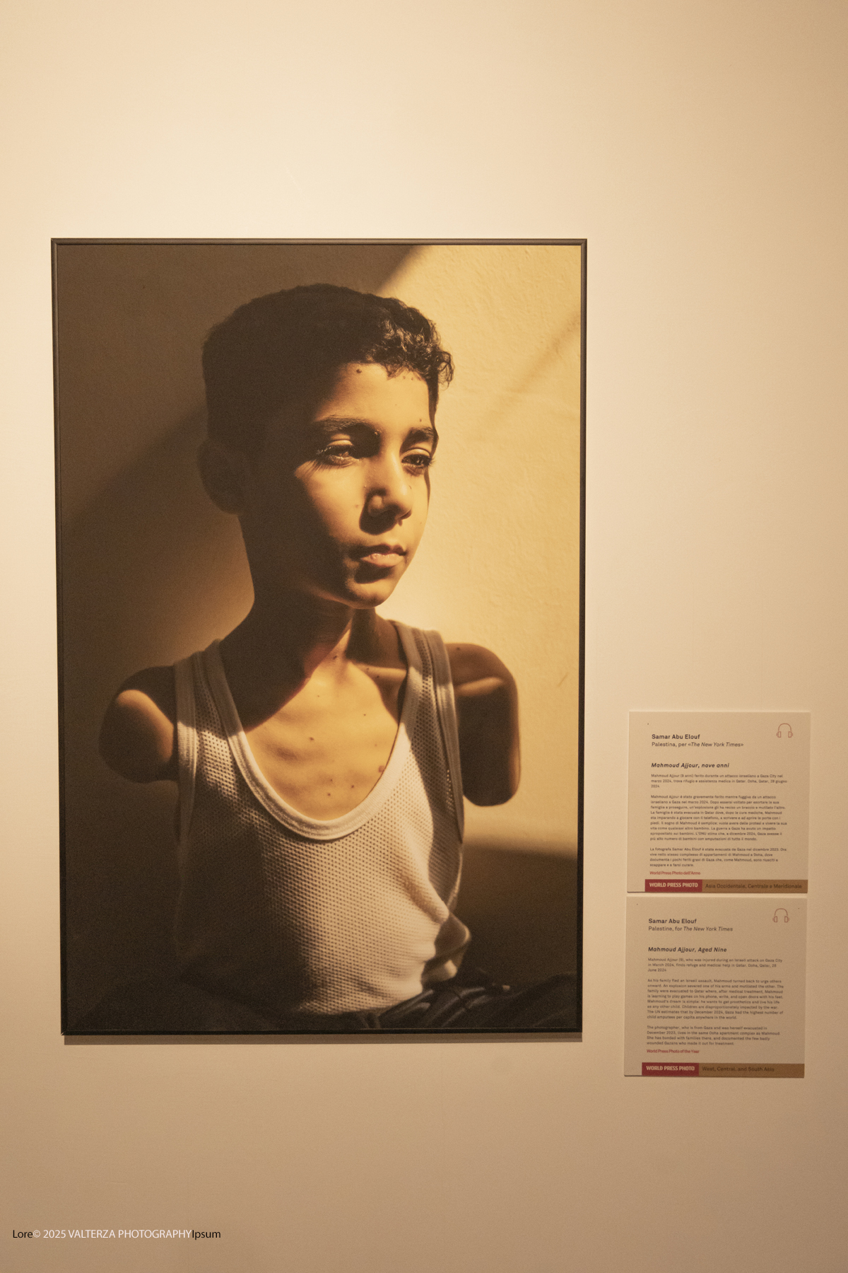 _DSF0231.jpg - World Press Photo Exhibition 2025 all’Accademia Albertina di Torino Il percorso espositivo presenta i lavori pubblicati dalle più autorevoli testate internazionali – da National Geographic a BBC, da CNN a Le Monde ed El PaÃs – e si conferma uno degli appuntamenti più attesi  per chi vuole comprendere il mondo attraverso lo sguardo dei reporter. Nella fotoPhoto of the Year  Fotografa Samar Abu Elouf , soggetto Palestina Mahmoud Ajjour  bimbo di 9 anni gravemente ferito in un attacco israeliano